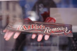 Tattoo verwijderen in Den Haag: deskundigheid, techniek en vertrouwen